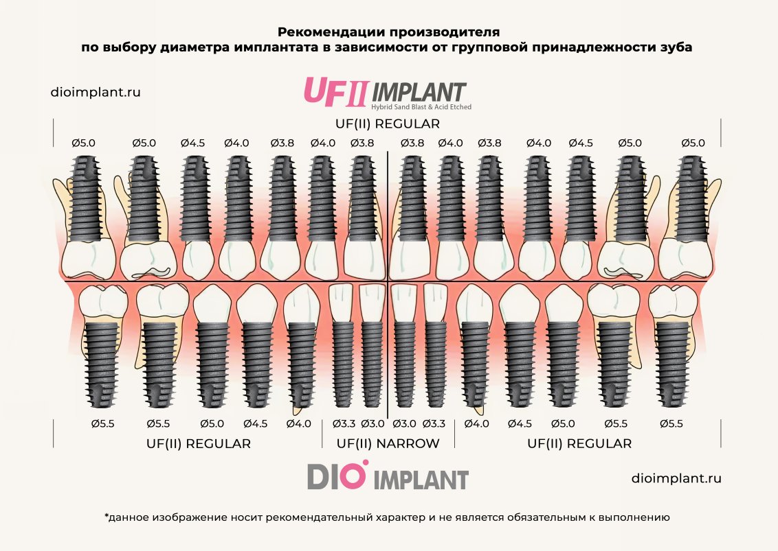 рекомендации производителя Dio Implant